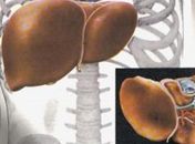 As Hepatites Virais são doenças causadas pelos vírus A, B, C ou D que provocam inflamação no fígado 