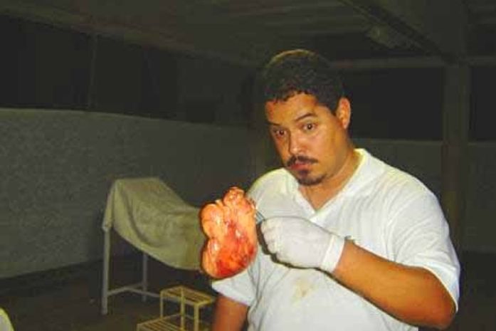 Dr. Fritz durante um procedimento cirurgico