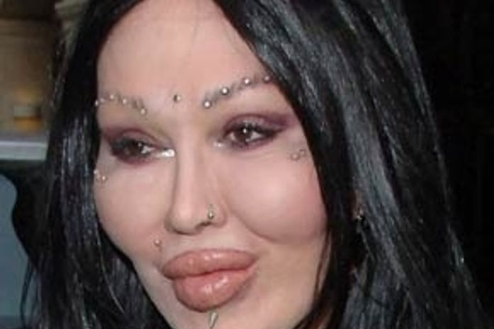 Depois de quase perder mandíbula por cirurgia, Pete Burns faz plástica