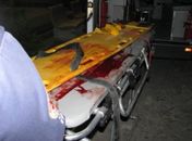 Vítima perdeu muito sangue e sofreu traumatismo