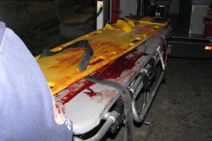 Vítima perdeu muito sangue e sofreu traumatismo