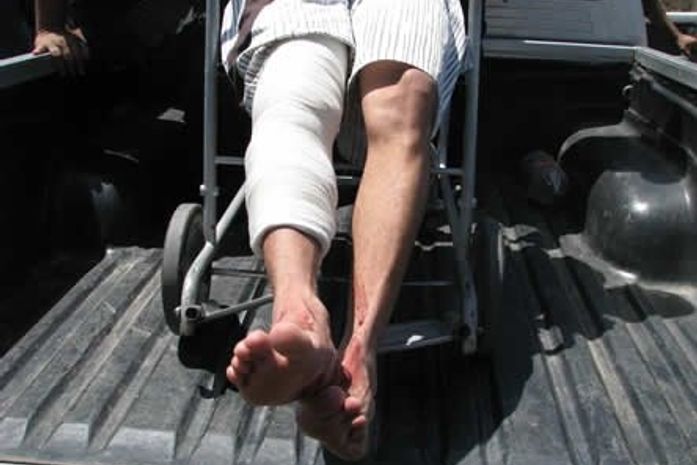 Silas recebeu 30 pontos na perna e não pode se locomover.