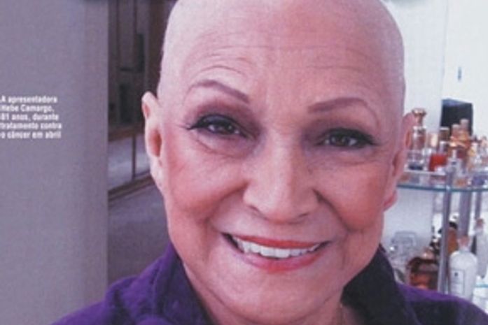 Revista publica foto de Hebe careca durante tratamento médico