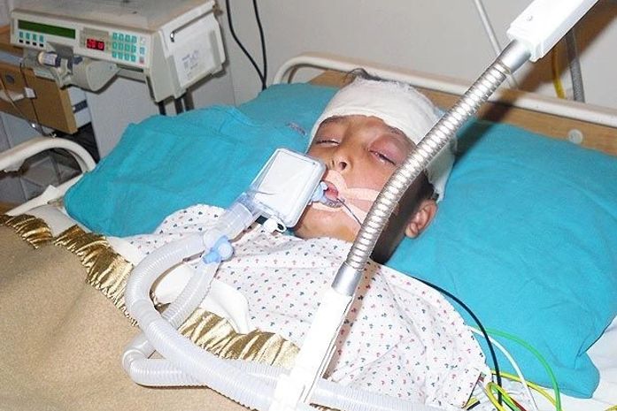 Cirurgia inovadora salva menino de 8 anos com doença rara