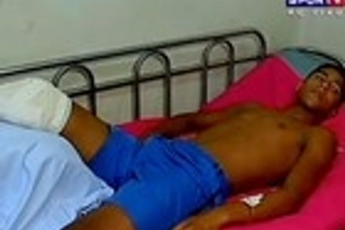 Promessa do futebol maranhense tem perna amputada por acidente de moto