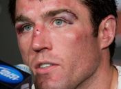 Chael Sonnen.
