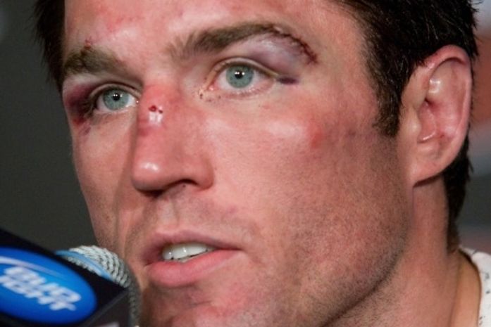Chael Sonnen.