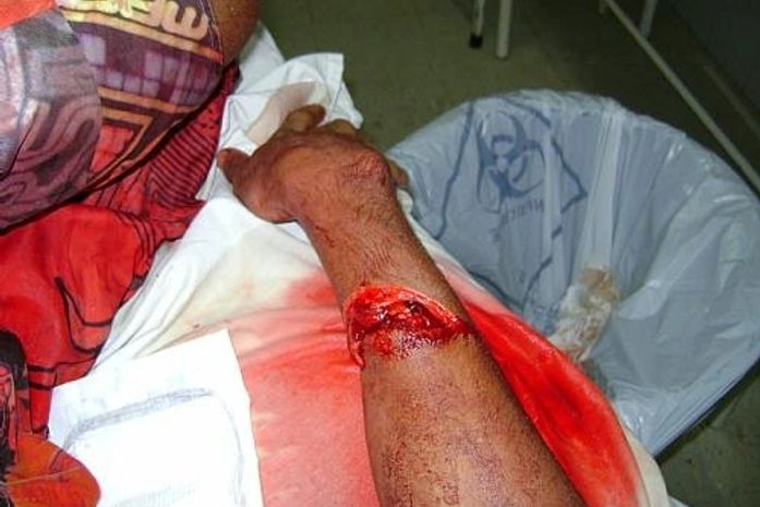 Assassino é golpeado com uma foice após tentar matar indivíduo