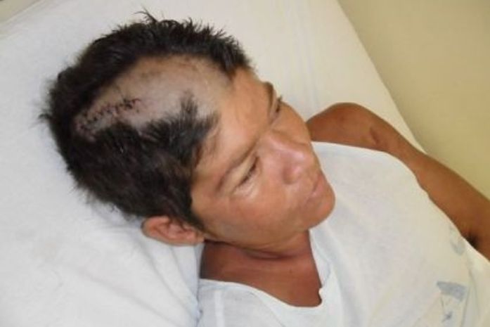 Metalúrgico agride mulher a pedradas em Delmiro Gouveia