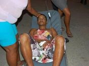 Dois jovens acabam esfaqueados após comemoração em bar