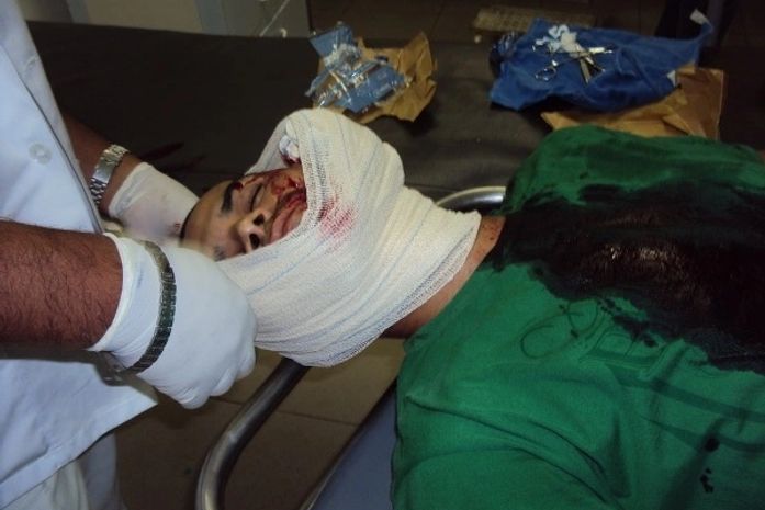 Jovem é ferido durante desfile de bloco em São Miguel dos Campos