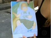 Bebê que teve perna amputada segue em berçário de alto risco, diz hospital