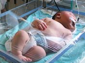 Bebê Gustavo tem 54 centímetros de altura em Salvador