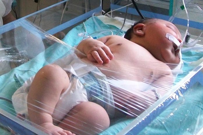 Bebê Gustavo tem 54 centímetros de altura em Salvador