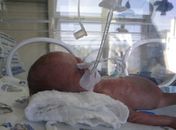 Aos 20 dias, Lavínia permanecia internada na UTI
neonatal