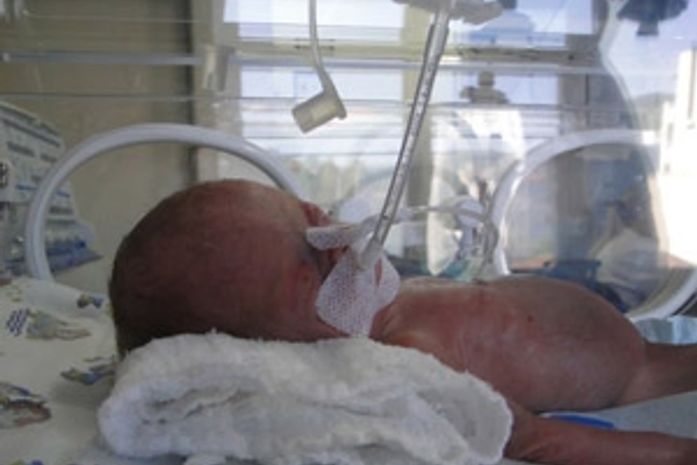 Aos 20 dias, Lavínia permanecia internada na UTI
neonatal