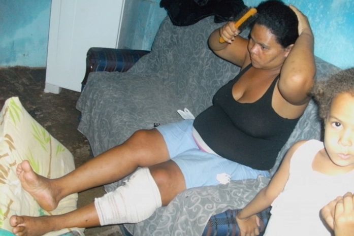 Josineide Atingida na Perna