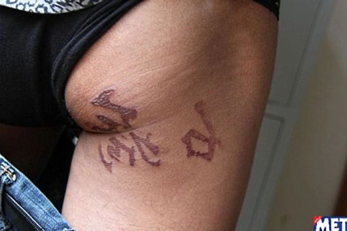 Misturar bisturi com cachaça dá nisso!