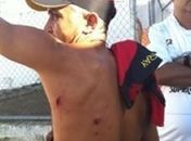 Dirigente do Sport acusa torcida do ASA de agressão