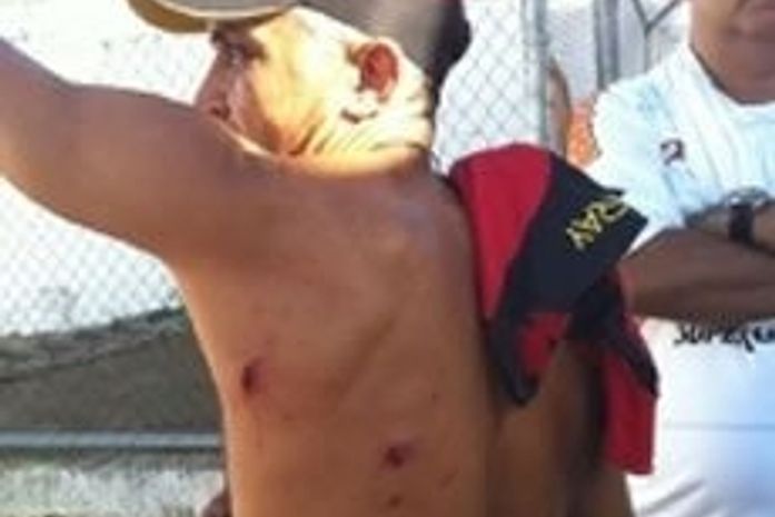 Dirigente do Sport acusa torcida do ASA de agressão