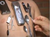 Menino de 11 anos atrai objetos metálicos ao corpo no RN