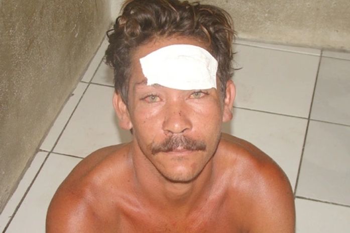 Denilson Ferreira Gonçalves, 34