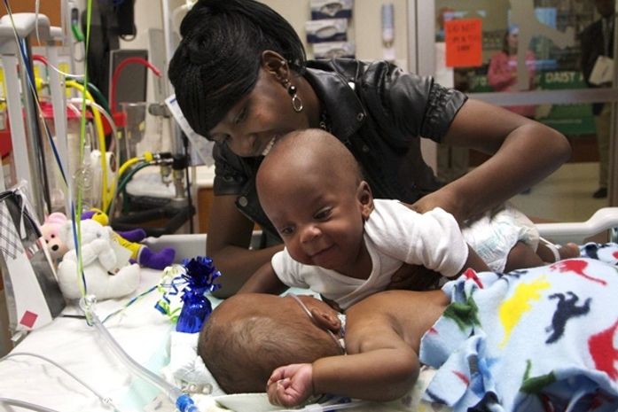 Gêmeos siameses se abraçam após cirurgia de 13 horas nos EUA