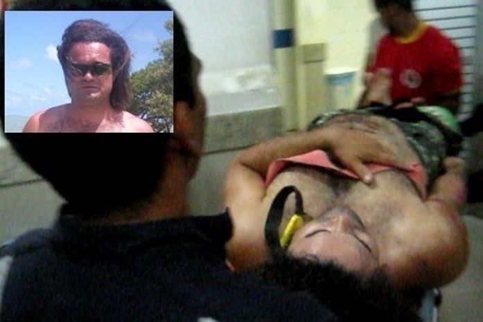 Cantor tem a perna amputada após tentativa de homicídio em São Miguel dos Campos