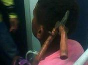 RJ: menino atingido por alicate em briga recebe alta do hospital