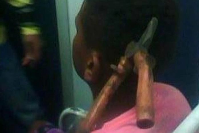 RJ: menino atingido por alicate em briga recebe alta do hospital