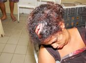 Homem briga com esposa e joga televiso na cabeça dela