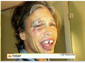 Durante passagem pelo Paraguai, Steven Tyler cai no banho e quebra dois dentes