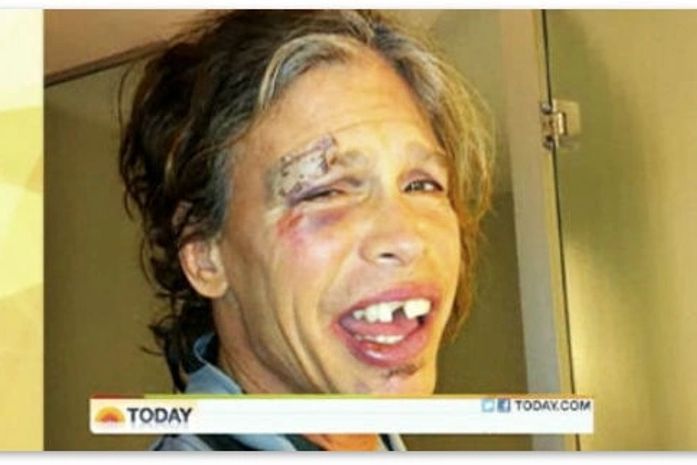 Durante passagem pelo Paraguai, Steven Tyler cai no banho e quebra dois dentes