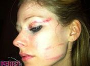 Avril, após ser agredida por cinco pessoas em um hotel de Hollywood