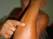 Homossexual denuncia espancamento na Barra de Santo Antônio