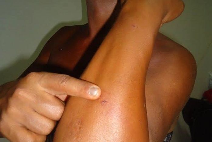 Homossexual denuncia espancamento na Barra de Santo Antônio