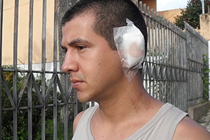 Soldado tem parte de orelha arrancada após confusão em MG