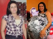 Advogado de falsa grávida divulga foto da mulher sem a barriga