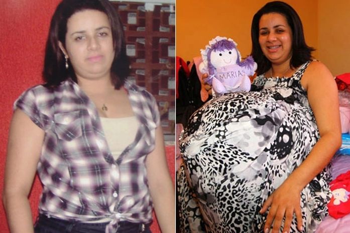 Advogado de falsa grávida divulga foto da mulher sem a barriga