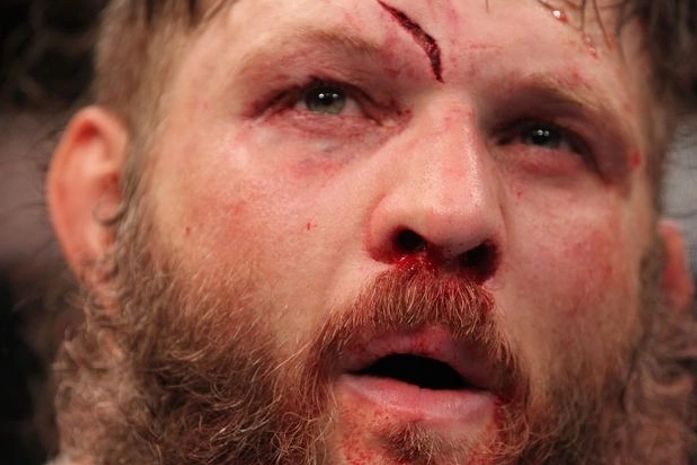 ROy Nelson saiu muito machucado por Fabrício Werdum.