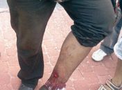 Luciano da Silva disse que foi atingido por militares do Bope