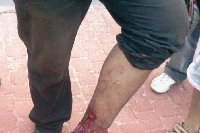 Luciano da Silva disse que foi atingido por militares do Bope