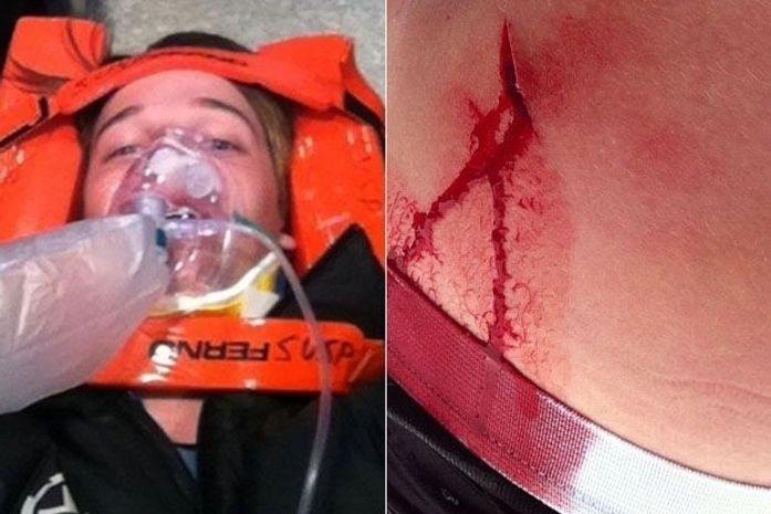 Filho de Schwarzenegger sofre acidente e é hospitalizado