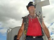 Cantor arapiraquense tem perna amputada após acidente