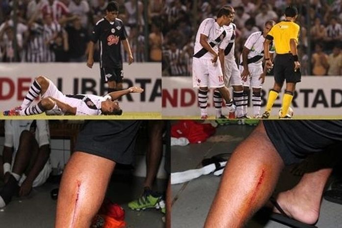 A perna esquerda de Diego Souza e as marcas ignoradas pelo árbitro chileno