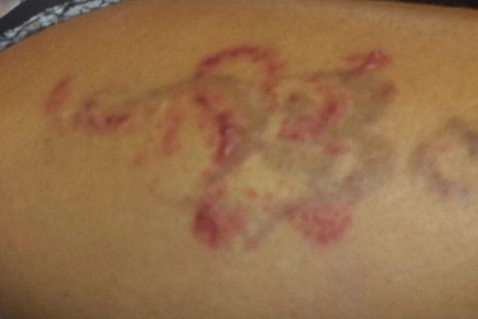 Viviane Araújo apaga tatuagem com nome de Belo e posta foto