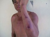 Após discussão, homem é agredido e ferido pela companheira