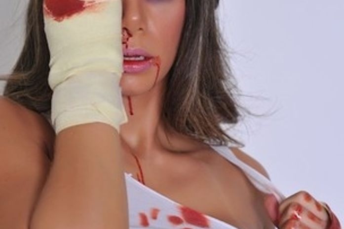 Vice do Miss Bumbum pede desculpas por fotos com hematomas