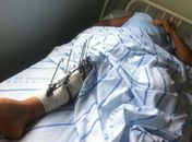 Família de gari atropelado pede doações através das redes sociais