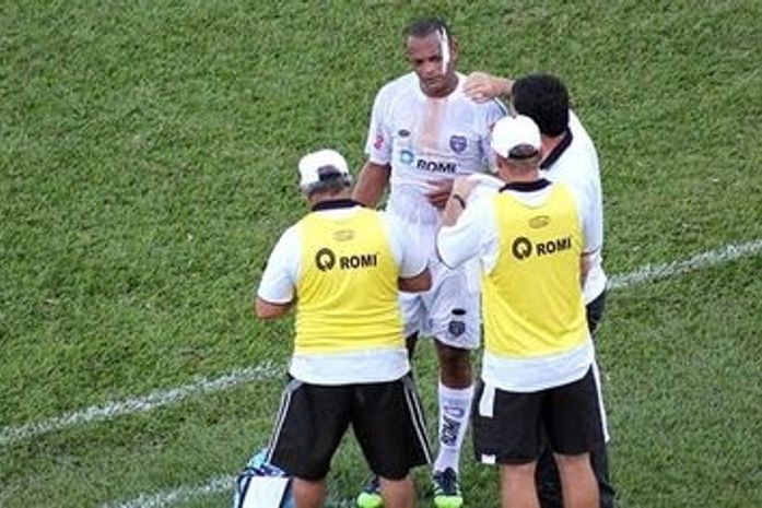 Após prisão, Tuta leva pontos no rosto e faz gol em vitória do União